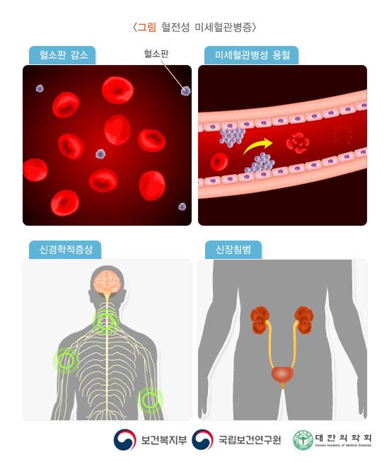 혈전성 미세혈관병증