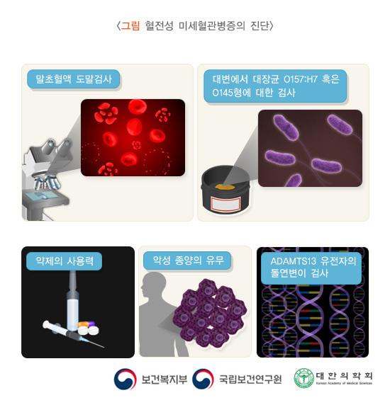 혈전성 미세혈관병증의 진단