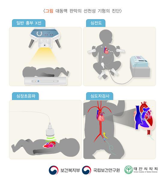 대동맥 판막의 선천성 기형의 진단