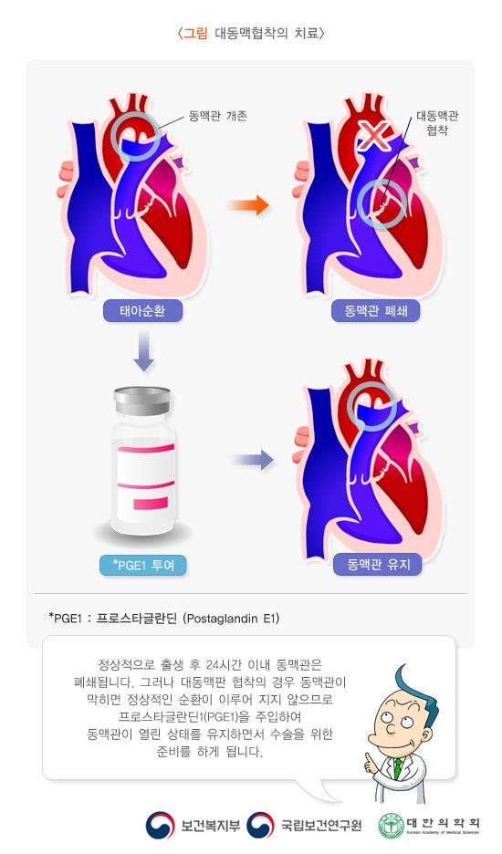 대동맥판 협착과 PGE1 치료의 효과