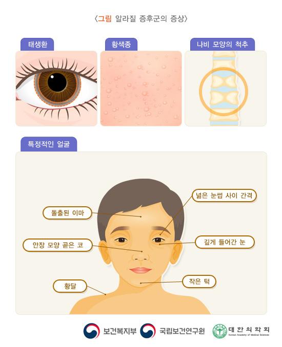 알라질 증후군의 증상