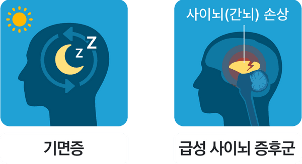 기면증, 급성 사이뇌 증후군