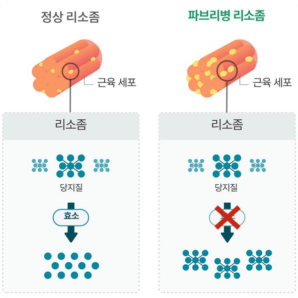 파브리병 리소좀