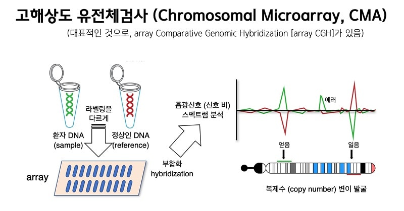 고해상도 유전체검사(Chromosomal Microarray, CMA) 그림. (대표적인 것으로, array Comparative Genomic Hybridization [array CGH]가 있음) 1.환자 DNA(sample)과 정상인 DNA(reference)의 라벨링을 다르게 표시하여 array를 만든다. 해당 array를 부합화(hybridization)하여 흡광신소 (신호 비) 스펙트럼 분석을 통해 복제수 (copy number) 변이 발굴을 한다.
