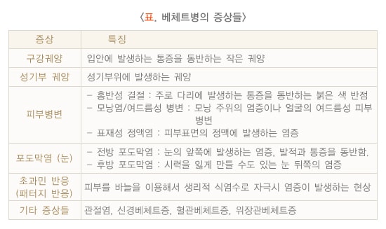 베체트병의 다양한 증상들