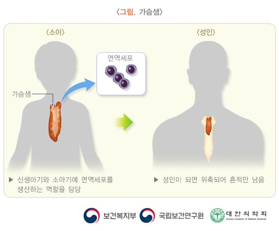 가슴샘