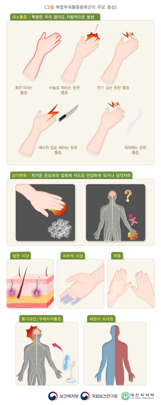 복합부위통증증후군의 주요 증상