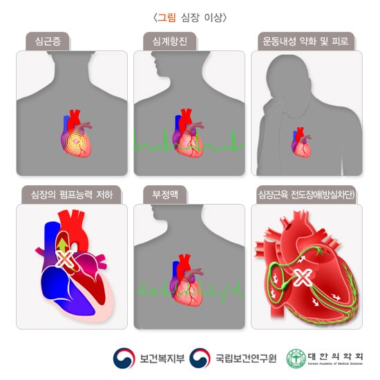 심장 이상