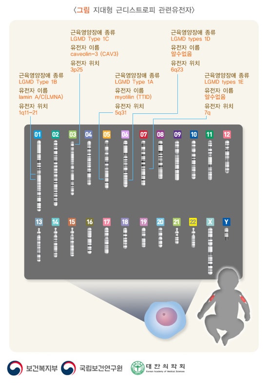 지대형 근디스트로피 관련 유전자