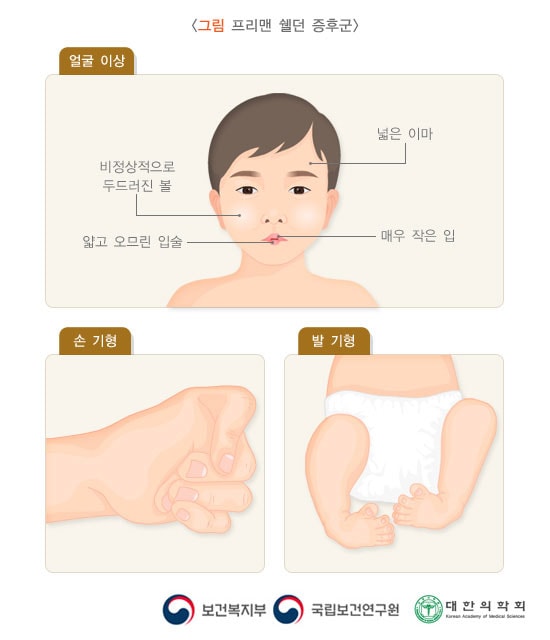 프리맨 쉘던 증후군