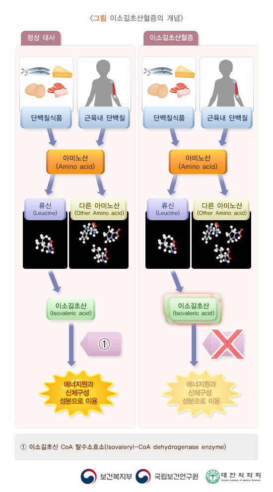 이소길초산혈증의 개념