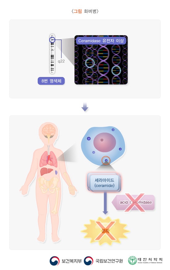 화버병