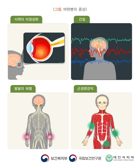 바텐병의 증상