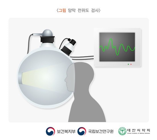 레베르 선천성 흑암시 진단 검사인 망막 전위도 검사 예시 이미지. 보건복지부, 국립보건연구원, 대한의학회