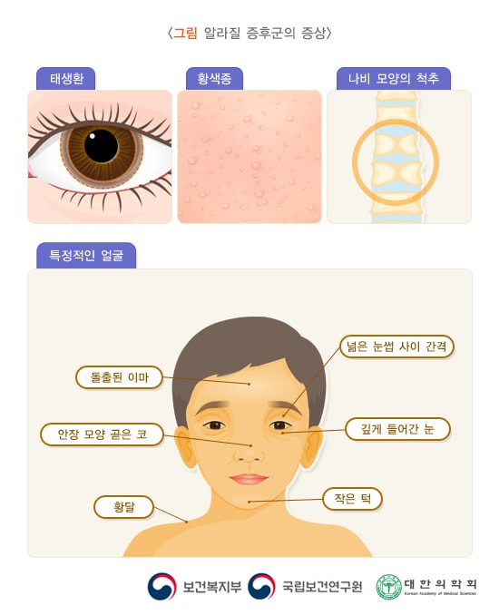 알라질 증후군의 증상