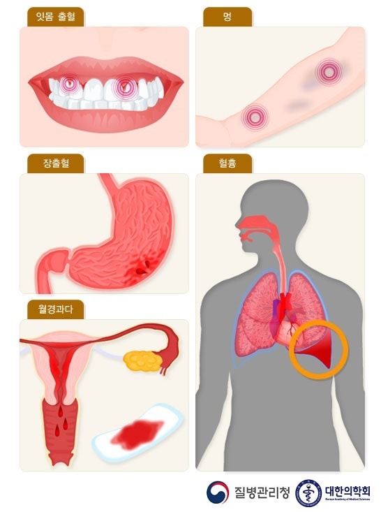 제1인자 결필증의 증상