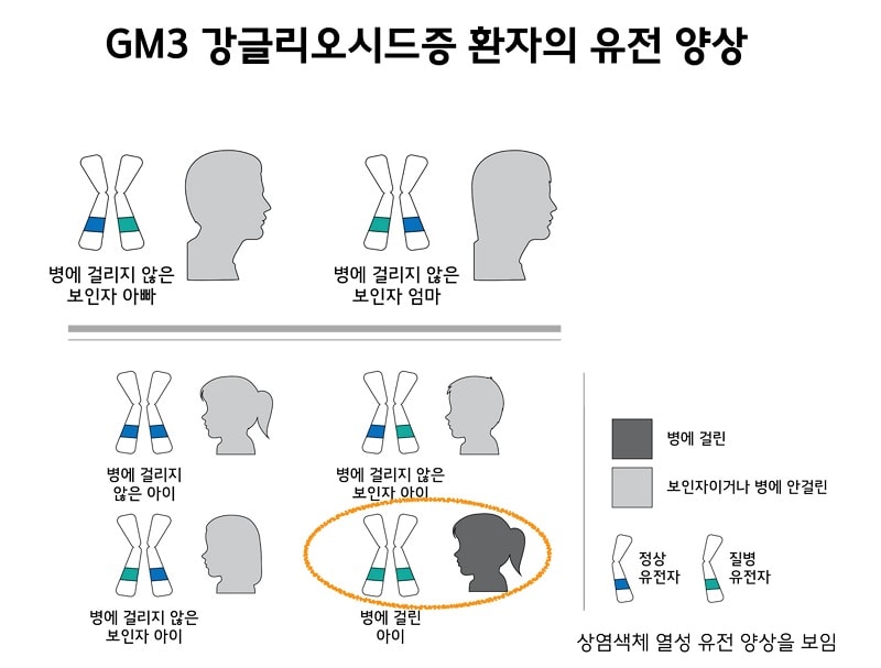 GM3 강글리오시드증 환자의 유전 양상 그림. 정상유전자와 질병유전자를 각각 하나씩 가진 병에 걸리지 않은 보인자 아빠와 병에 거릴지 않은 보인자 엄마 사이의 4가지 유전 양상. 정상 유전자만을 가진 병에 걸리지 않은 아이. 정상 유전자와 질병 유전자를 모두 가진 병에 걸리지 않은 보인자 아이. 질병 유전자만을 가진 병에 걸린 아이. 상염색체 열성 유전 양상을 보임