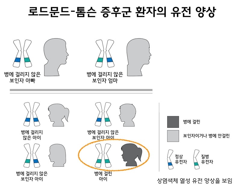 로드문드-톰슨 증후군 환자의 유전 양상 그림. 정상유전자와 질병 유전자를 하나씩 가진 병에 걸리지 않은 보인자 아빠와 병에 걸리지 않은 보인자 엄마. 정상유전자를 2개 가진 병에 걸리지 않은 아니, 정상유전자와 질병유전자를 하나씩 가진 보인자 아이, 2개의 질병유전자를 가진 병에 걸린 아이. 상염색체 열성 유전 양상을 보임.