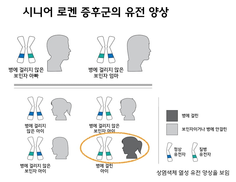 시니어 로켄 증후군의 유전 양상 그림