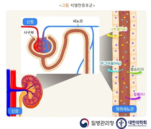 지텔만 증후군의 신원과 신장과 마그네슘(Mg), 나트륨(Na), 칼륨(K), 염소(Cl)와 같은 전해질이 빠져나가는 원위세뇨관 그림