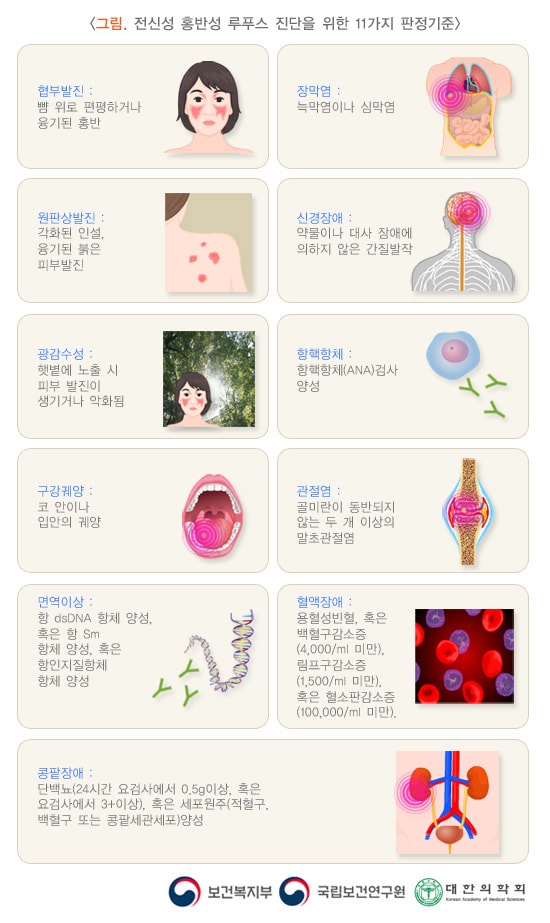 전신성 홍반성 루푸스 진단을 위한 11가지 판정기준