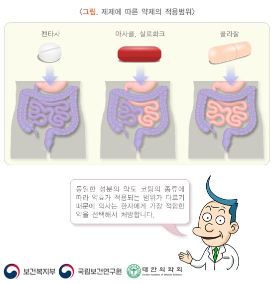 제제에 따른 약제의 적용범위 그림. 펜타사. 아사콜,샬로화크. 콜라잘. 동일한 성분의 약도 코팅의 종류에 따라 약효가 적용되는 범위가 다르기 때문에 의사는 환자에게 가장 적합한 약을 선택해서 처방합니다. 보건복지부, 국립보건연구원, 대한의학회