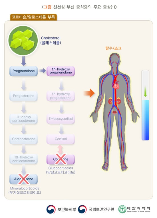 선천성 부신 증식증의 주요 증상(1)