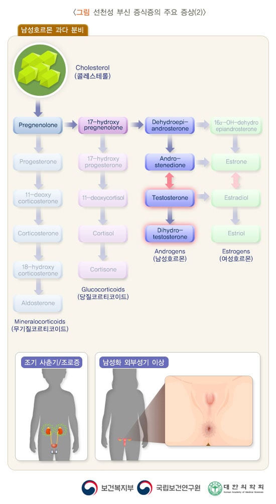 선천성 부신 증식증의 주요 증상(2)