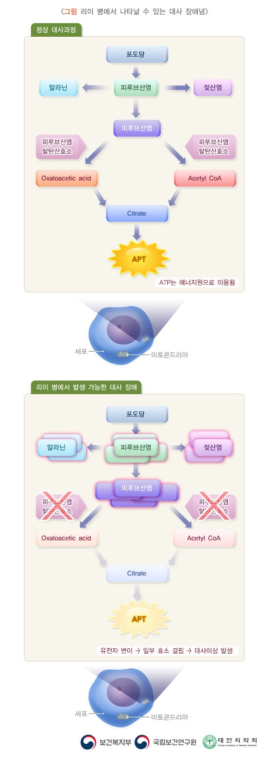 리이 병에서 나타날 수 있는 대사 장애