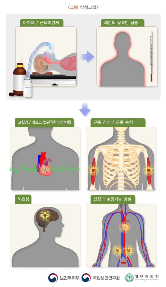 악성고열