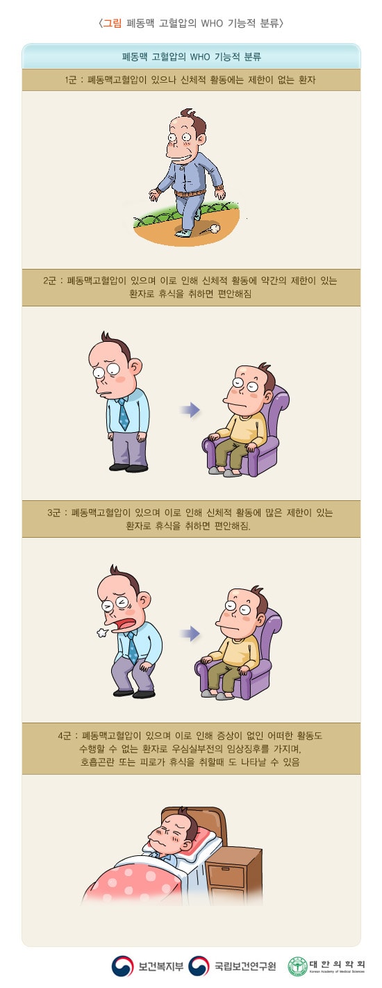 폐동맥 고혈압의 WHO 기능적 분류