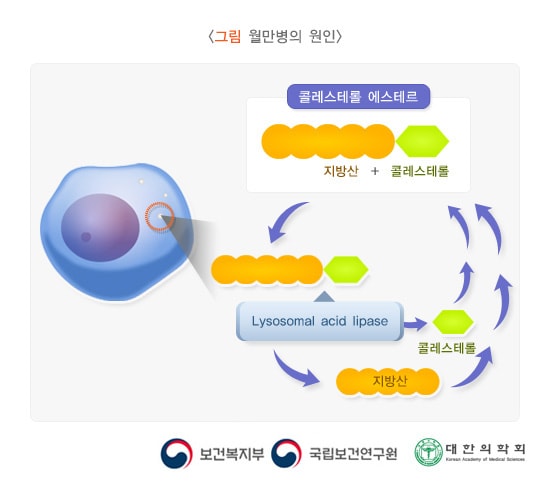 월만병의 원인