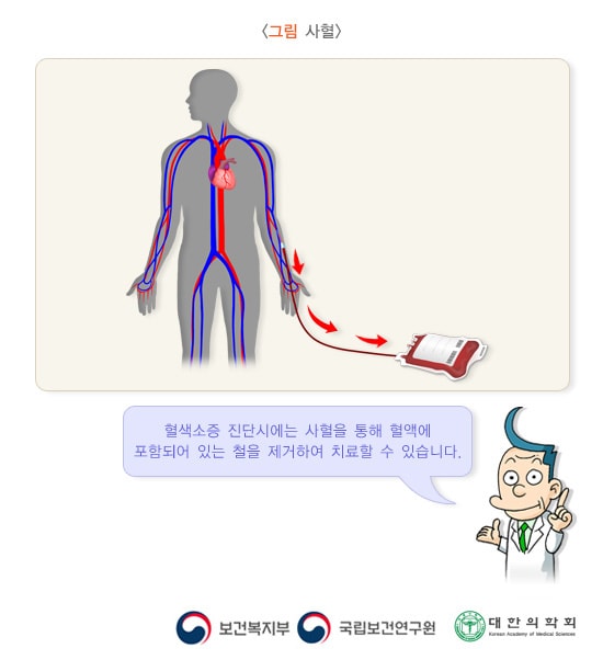 사혈