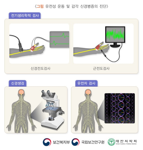 유전성 운동 및 감각 신경병증의 진단