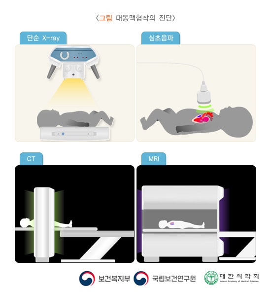 대동맥협착의 진단