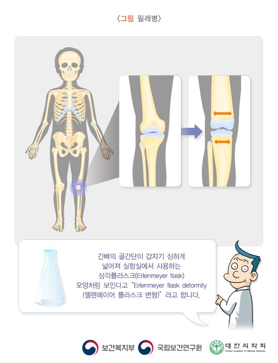 필레병