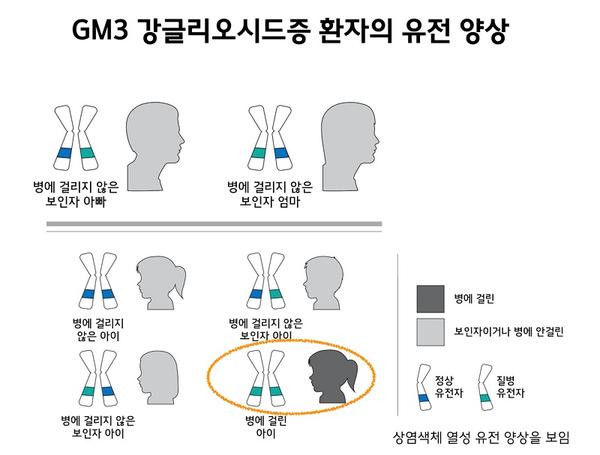 GM3 강글리오시드증 환자의 유전 양상 그림. 정상유전자와 질병유전자를 각각 하나씩 가진 병에 걸리지 않은 보인자 아빠와 병에 거릴지 않은 보인자 엄마 사이의 4가지 유전 양상. 정상 유전자만을 가진 병에 걸리지 않은 아이. 정상 유전자와 질병 유전자를 모두 가진 병에 걸리지 않은 보인자 아이. 질병 유전자만을 가진 병에 걸린 아이. 상염색체 열성 유전 양상을 보임