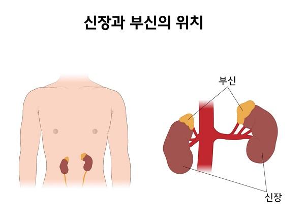 신장과 부신의 위치 그림