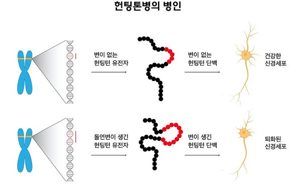 헌팅톤병의 병인 그림. 변이 없는 헌팅턴 유전자> 변이 없는 헌팅턴 단백> 건강한 신경세포. 돌연변이 생긴 헌팅턴 유전자> 변이 생긴 헝팅턴 단백> 퇴화된 신경세포