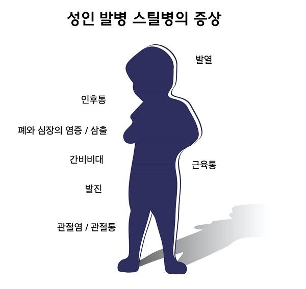 성인 발병 스틸병의 증상 그림-발열,인후통,폐와 심장의 염증/삼출,간비비대,근육통,발진,관절염/관절통