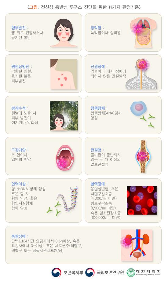 전신성 홍반성 루푸스 진단을 위한 11가지 판정기준