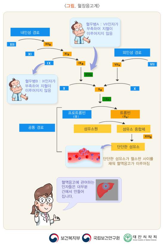 그림. 혈장응고계. 내인성경로. XII > XIIa. XI>XIa. IX(혈우병B:IX인자가 부족하여 지혈이 이루어지지 않음)>IXa. > VIIIa(혈우병A:VIII인자가 부족하여 지혈이 이루어지지 않음). X> Xa. 외인성경로. VII>VIIa. X>Xa. Xa 이후로 공통경로. Xa+Va. 프로트롬빈(II) > 트롬빈(IIa). 섬유소원 > 섬유소중합체(XIIIa) > 단단한 섬유소. 단단한 섬유소가 혈소판 사이를 채워 혈액응고가 이루어짐. 혈액응고에 관여하는 인자들은 대부분 간에서 만들어집니다. 보건복지부, 국립보건연구원, 대한의학회
