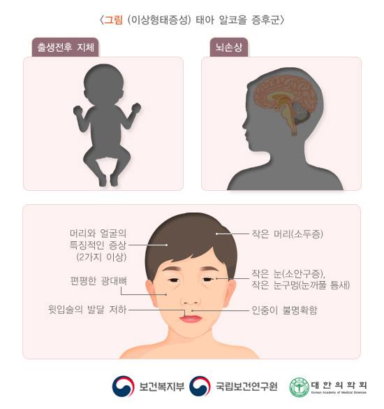 (이상형태증성) 태아 알코올 증후군