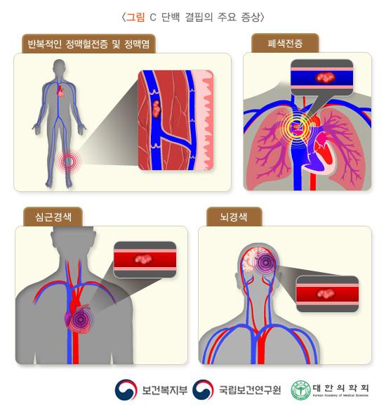 C 단백 결핍의 주요 증상