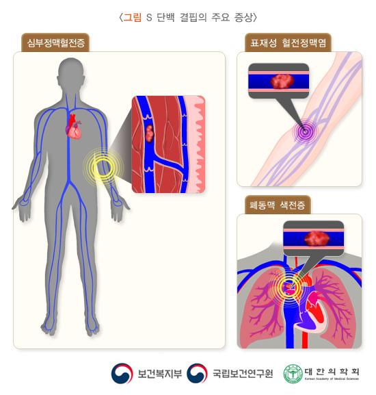 S 단백 결핍의 주요 증상