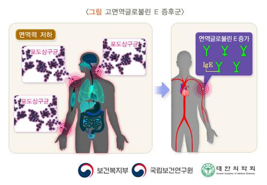 고면역글로불린 E 증후군