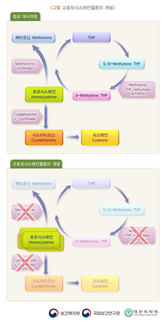 고호모시스테인혈증의 개념