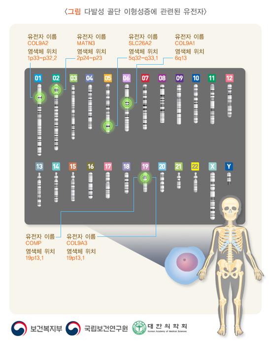 다발성 골단 이형성증에 관련된 유전자: COL9A2(위치:1p33-p32.2), MATN3(위치:2p24-p23), SLC26A2(위치:5q32-q33.1), COL9A1(위치:6q13), COMP(위치:19p13.1), COL9A3(위치:19p13.1)