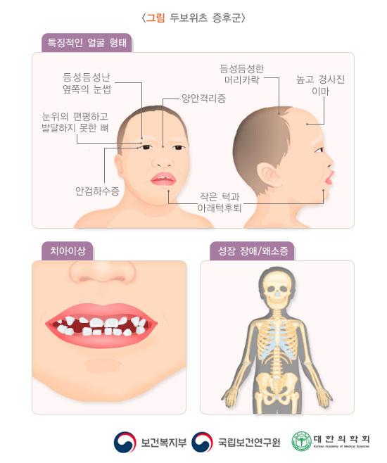 두보위츠 증후군