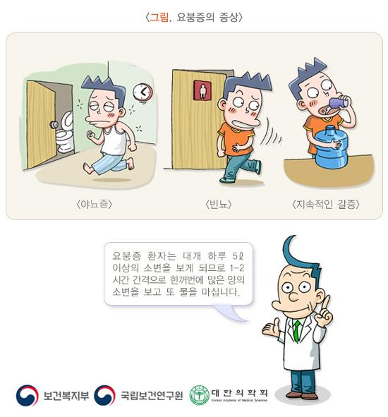 요붕증의 증상: 야뇨증, 빈뇨, 지속적인 갈증. 요붕증 환자는 대개 하루 5리터 이상의 소변을 보게 되므로 1-2시간 간격으로 한꺼번에 많은 양의 소변을 보고 또 물을 마십니다. 보건복지부, 국립보건연구원, 대한의학회.